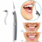 Pulitore-denti-tartaro-elettrico-Pulitore-dentale-ultrasuoni-Attrezzo-di-puli-353059920654