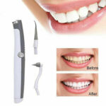 Pulitore-denti-tartaro-elettrico-Pulitore-dentale-ultrasuoni-Attrezzo-di-puli-353059920654-3